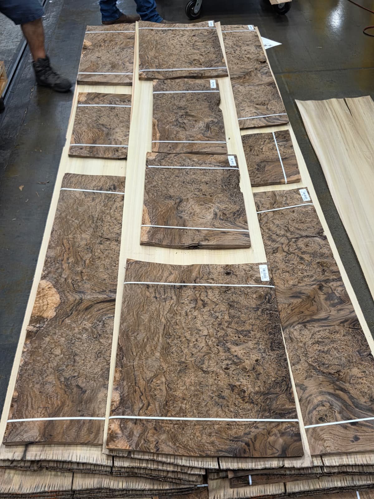 Luxury Veneers